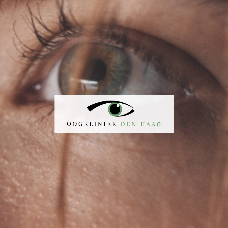 oogkliniek-homepageblok